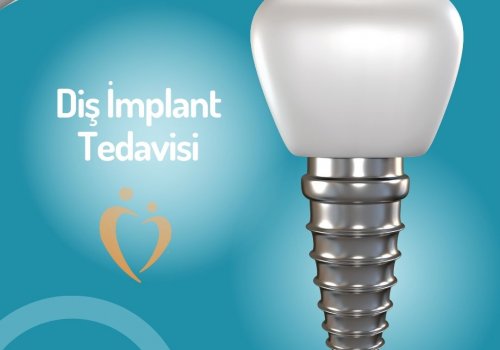 İmplant Tedavisi