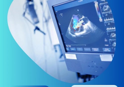 Transesophageal Echocardiography