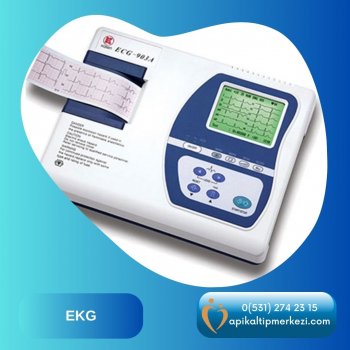 EKG