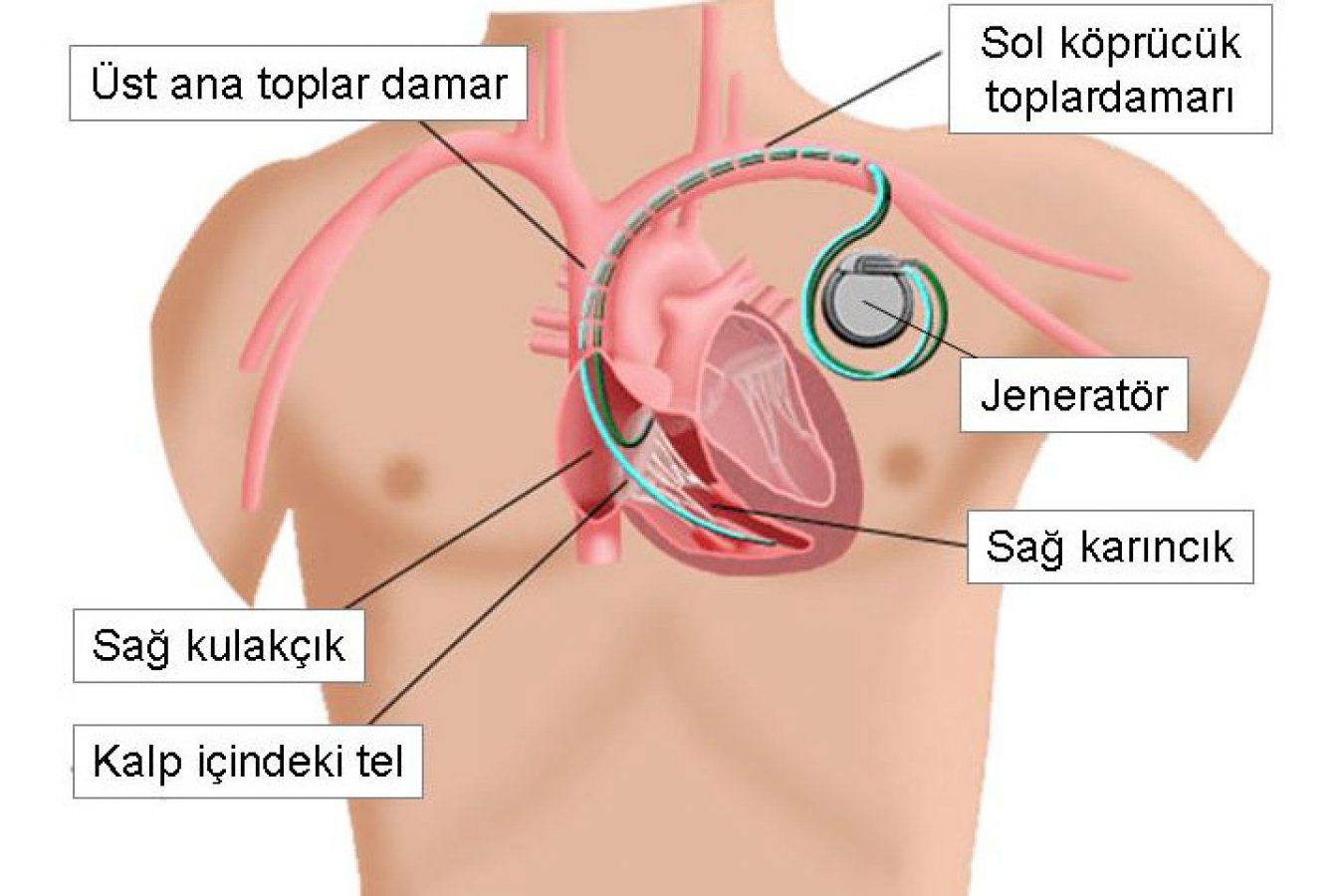 Eyvah Kalbim Ağrıyor