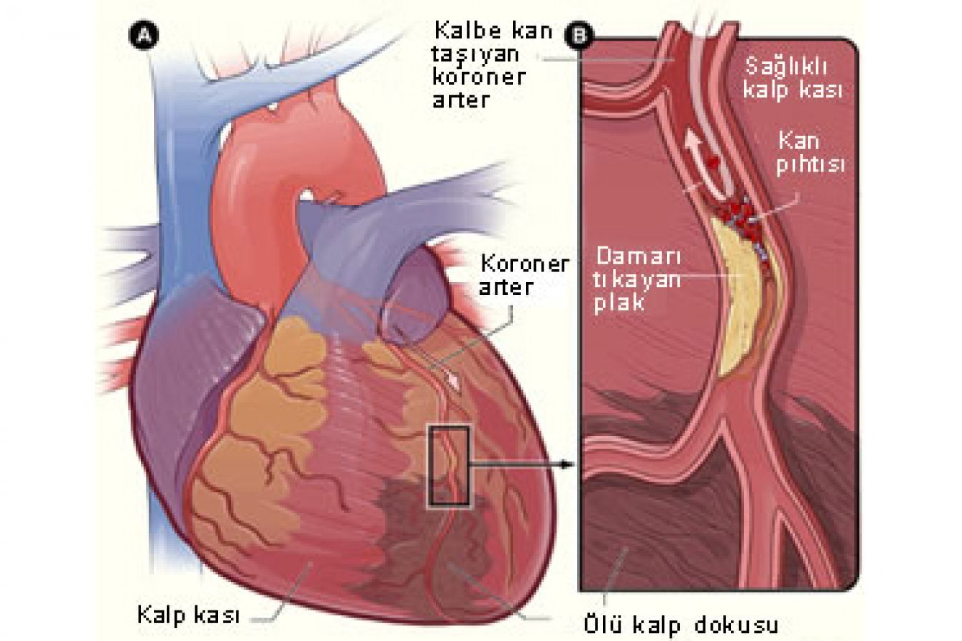 Kalp Krizi Hakkında