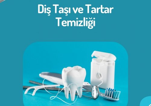 Diş Taşı ve Tartar Temizliği