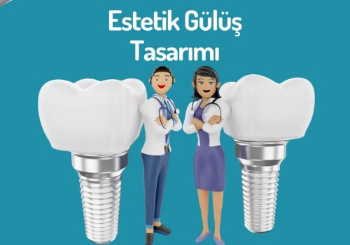 Estetik Gülüş Tasarımı